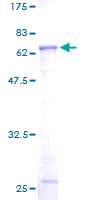 12.5% SDS-PAGE Stained with Coomassie Blue.